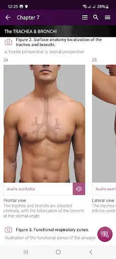 Play Chest X-Ray Interpretation