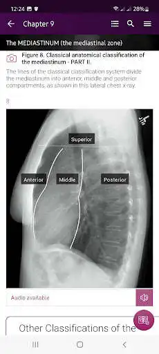 Play Chest X-Ray Interpretation