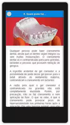 Play Clareamento de Dentes Play Clareamento de Dentes