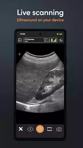 Play Clarius Ultrasound App as an online game Clarius Ultrasound App with UptoPlay