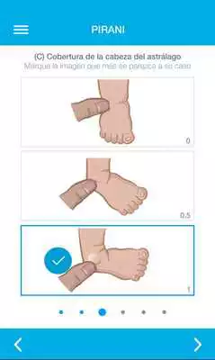 Play CLUBFOOT SCORE