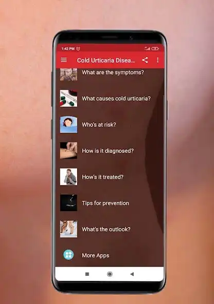 Play Cold urticaria - Causes, Diagn as an online game Cold urticaria - Causes, Diagn with UptoPlay