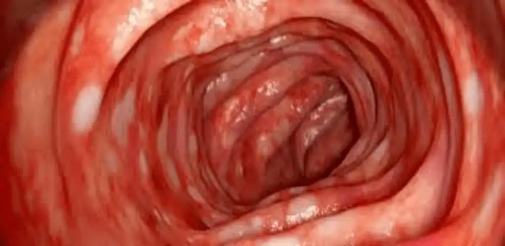Play com.colonandstomach.alshujiry as an online game com.colonandstomach.alshujiry with UptoPlay
