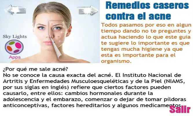 Play Como Curar El Acne Remedio
