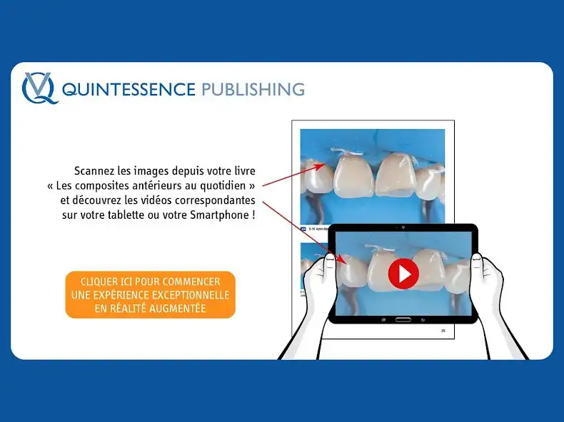 Play Composites antérieurs as an online game Composites antérieurs with UptoPlay