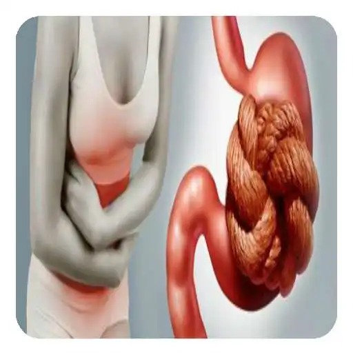Play Constipation Guide APK