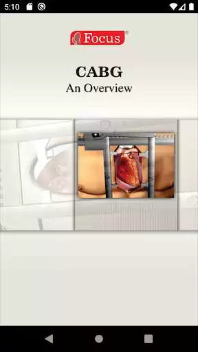 Play Coronary Artery Bypass Graft  and enjoy Coronary Artery Bypass Graft with UptoPlay