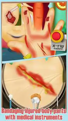 Play Crazy Hand Doctor