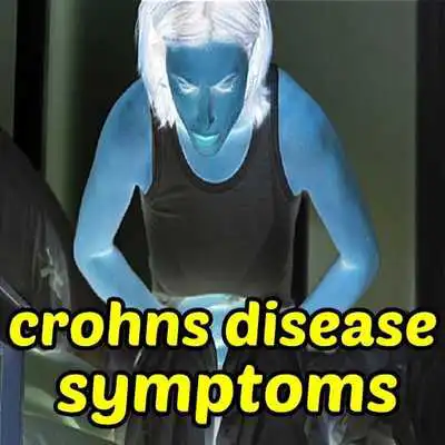 Play Crohns Disease Symptoms