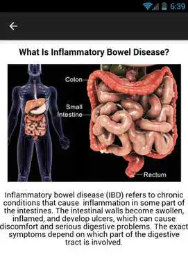 Play Crohns Disease Symptoms