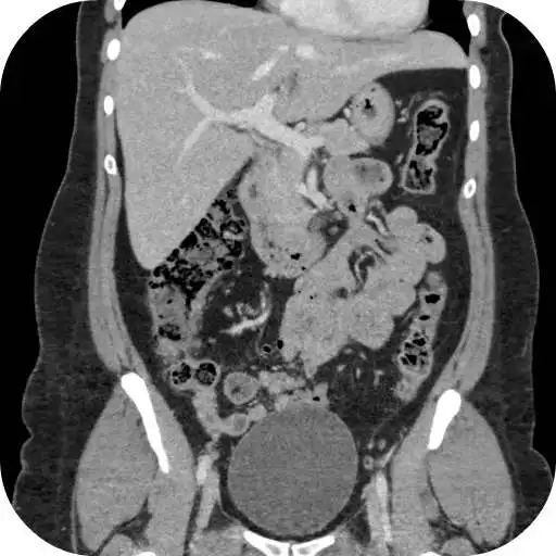 Play CT Abdomen Pelvis APK