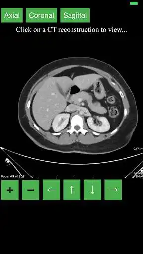 Play CT Abdomen Pelvis  and enjoy CT Abdomen Pelvis with UptoPlay