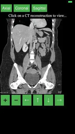 Play CT Abdomen Pelvis as an online game CT Abdomen Pelvis with UptoPlay