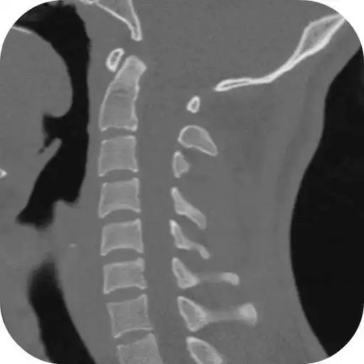 Play CT Cervical Spine APK