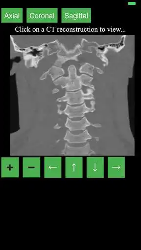 Play CT Cervical Spine as an online game CT Cervical Spine with UptoPlay