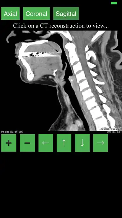 Play CT Neck as an online game online CT Neck with UptoPlay net.mdtoolkit.ctneck Play CT Neck as an online game CT Neck with UptoPlay