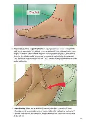 Play Curso de Acupuntura
