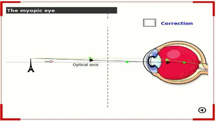 Play Defects of Vision