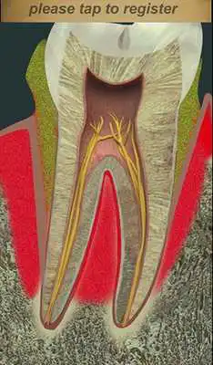 Play Dental Pain Lite