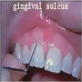 Free play online Dental Probing App Hygienist APK