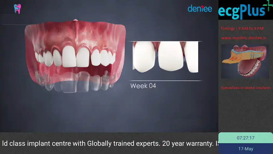 Play dentee TV - Online dental TV Channel  and enjoy dentee TV - Online dental TV Channel with UptoPlay