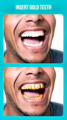 Play Dentist - editor as an online game online Dentist - editor with UptoPlay selfie.photo.apps.dentist Play Dentist - editor as an online game Dentist - editor with UptoPlay