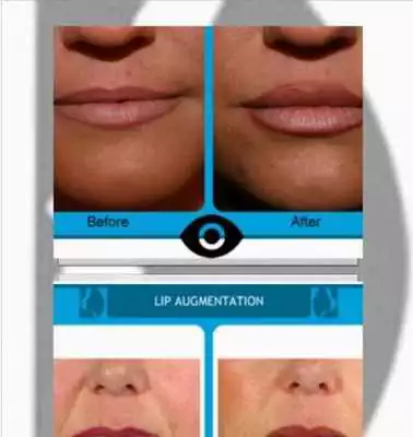 Play DERMADOC
