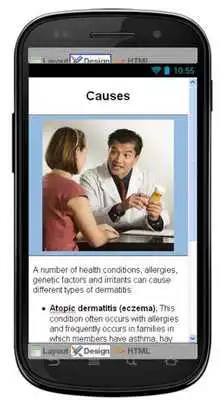Play Dermatitis Eczema Information