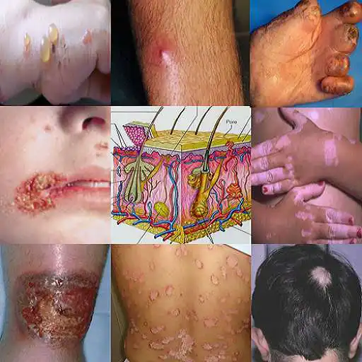 Run free android online Dermatology AZ Skin Management APK