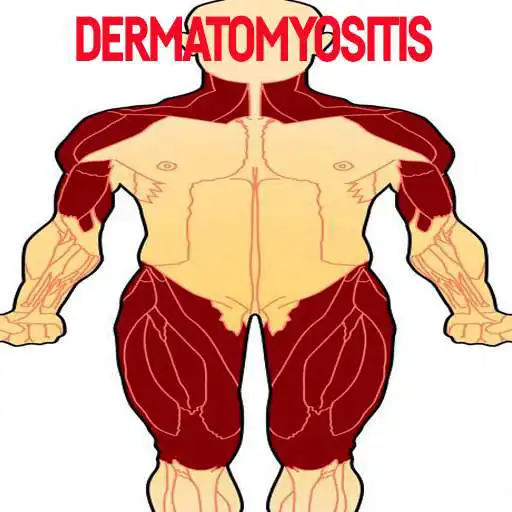 Free play online Dermatomyositis Disease APK