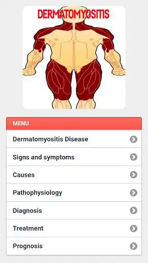 Play Dermatomyositis Disease
