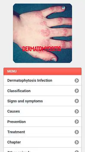 Play Dermatophytosis Infection