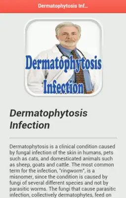Play Dermatophytosis Infection