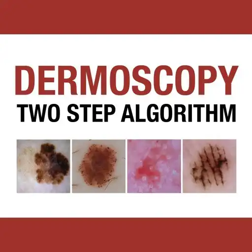 Play Dermoscopy Two Step Algorithm APK