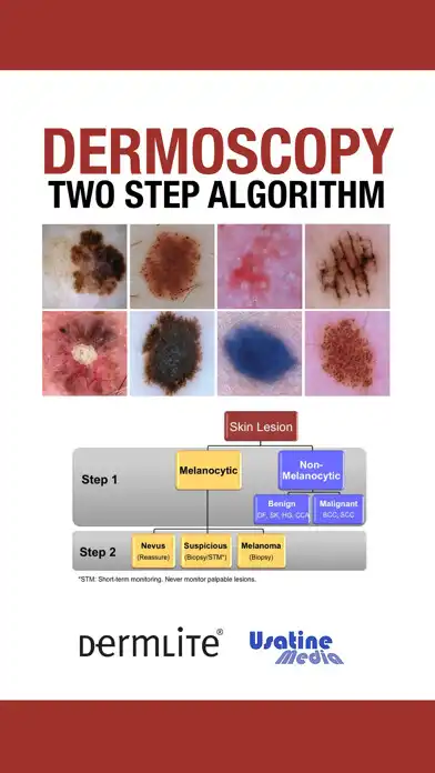 Play Dermoscopy Two Step Algorithm  and enjoy Dermoscopy Two Step Algorithm with UptoPlay