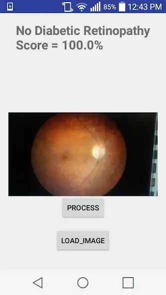 Play Diabetic Retinopathy Classifier  and enjoy Diabetic Retinopathy Classifier with UptoPlay