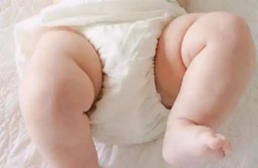 Play Diaper rash in Babies Tips  and enjoy Diaper rash in Babies Tips with UptoPlay