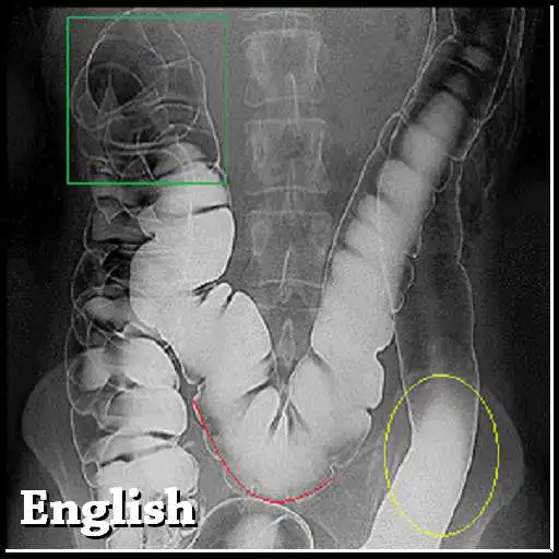 Free play online Digestive System exam question  APK