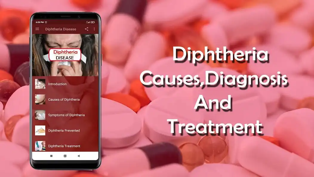 Play Diphtheria - Causes, Diagnosis  and enjoy Diphtheria - Causes, Diagnosis with UptoPlay