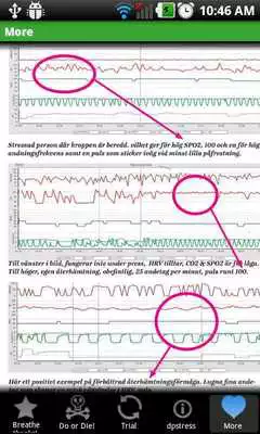 Play DP-stress light