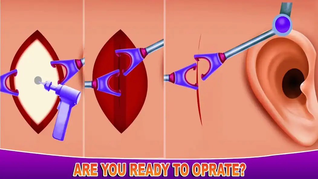 Play Ear Cleaning Games Ear Doctor  and enjoy Ear Cleaning Games Ear Doctor with UptoPlay