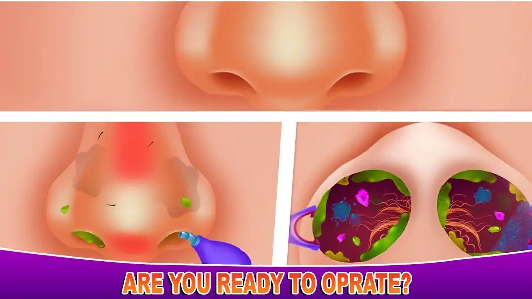 Play Ear Cleaning Games Ear Doctor as an online game Ear Cleaning Games Ear Doctor with UptoPlay