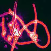 Free play online Ebola virus, infected? APK
