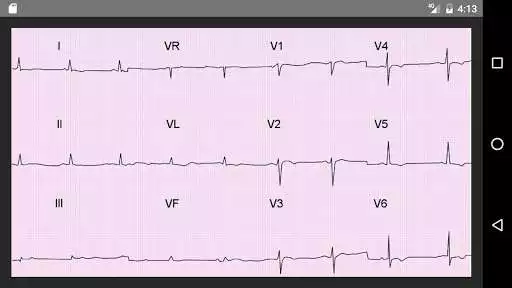 Play ECG 100 Clinical Cases