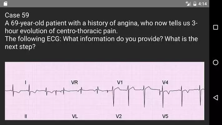 Play ECG 100 Clinical Cases