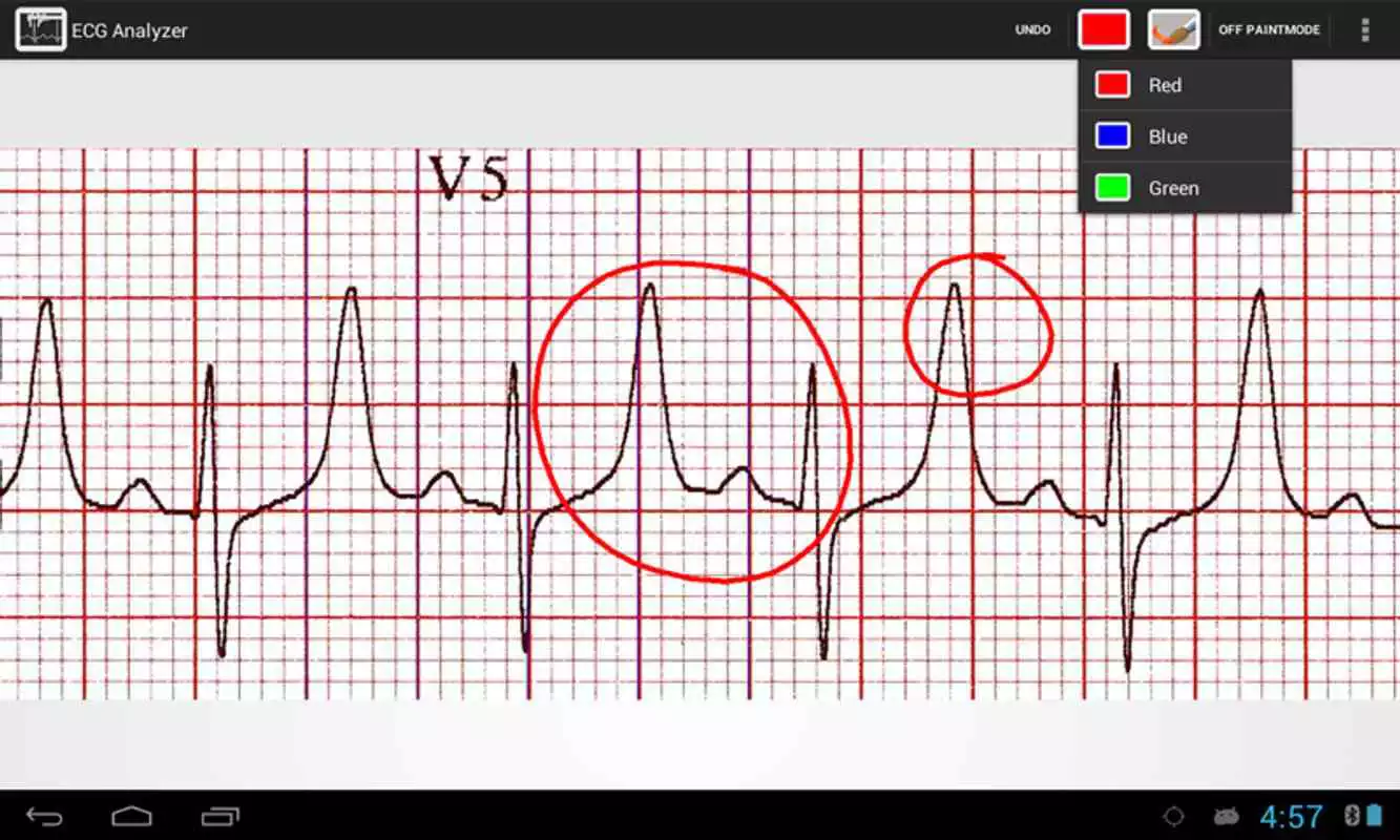 Play ECG Analyzer