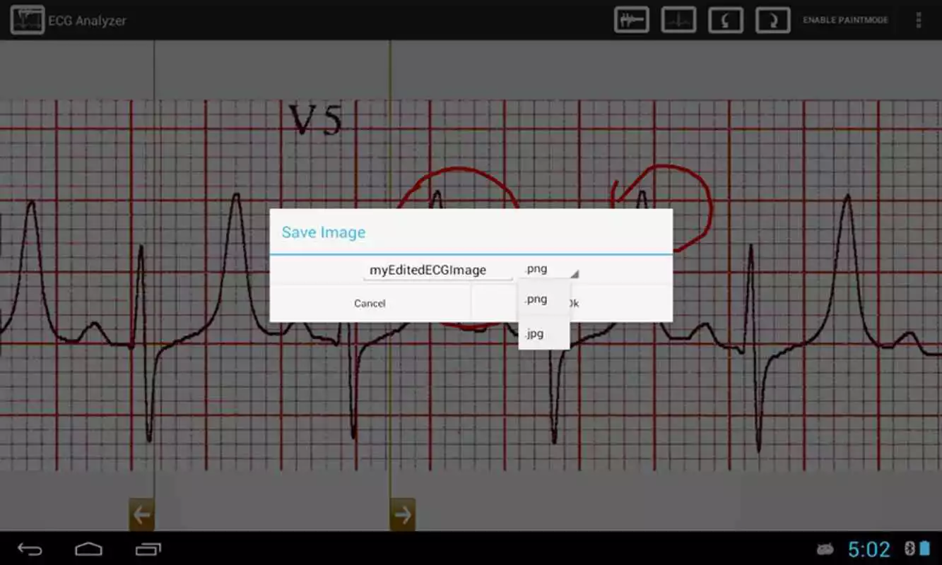 Play ECG Analyzer
