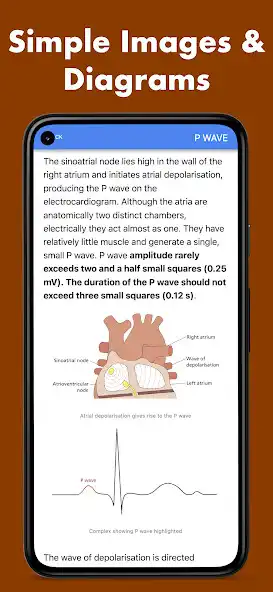 Play ECG Basics Lite as an online game ECG Basics Lite with UptoPlay