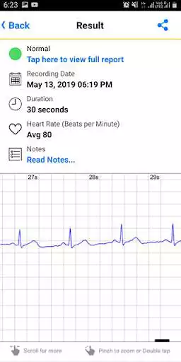 Play ECG Check