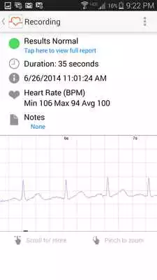 Play ECG Check